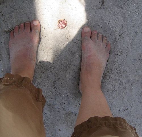 Imagen "Boy's feet", de Dominio Público. Fuente: Wikipedia (http://commons.wikimedia.org/wiki/File:Boy%27s_Feet.jpg)